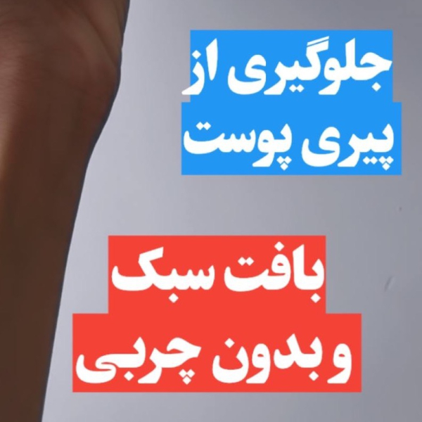 صد افتاب ویتابلا